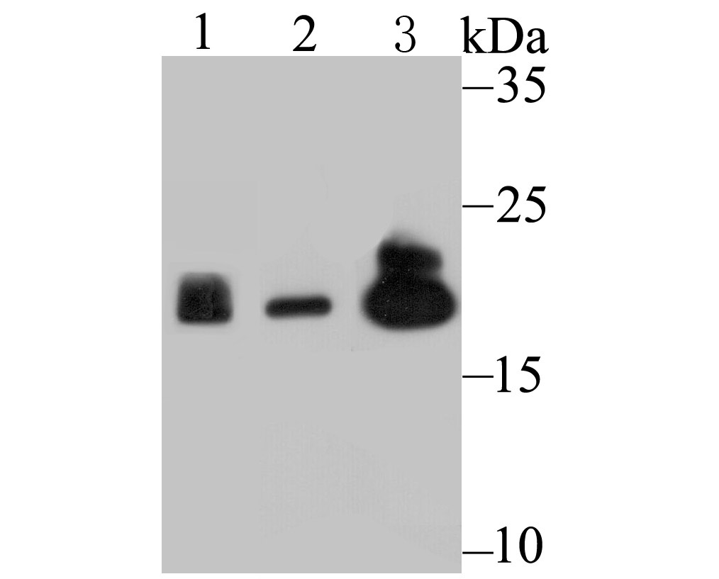 Proteasome 20S LMP2 Antibody