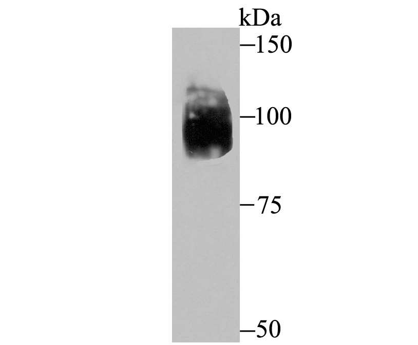 HIF-2 alpha Antibody
