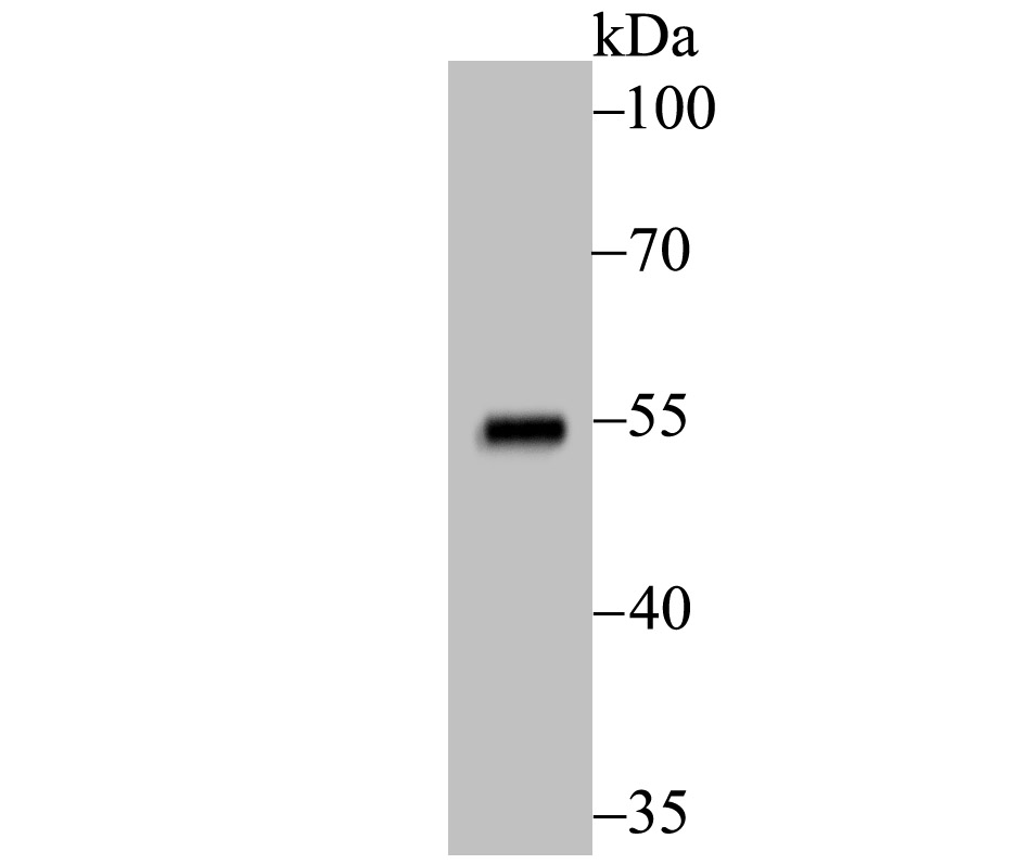 Mutant p53 Antibody