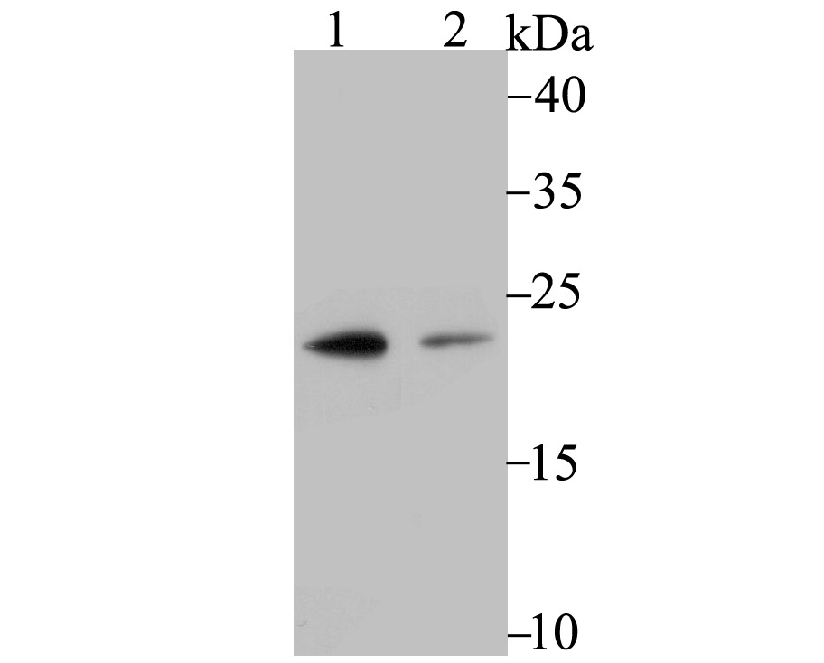 Proteasome 20S LMP7 Antibody
