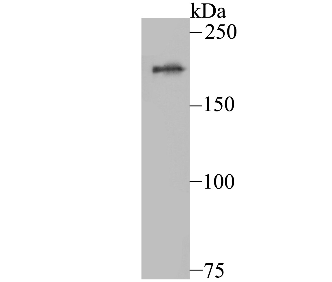 KDM5A Antibody
