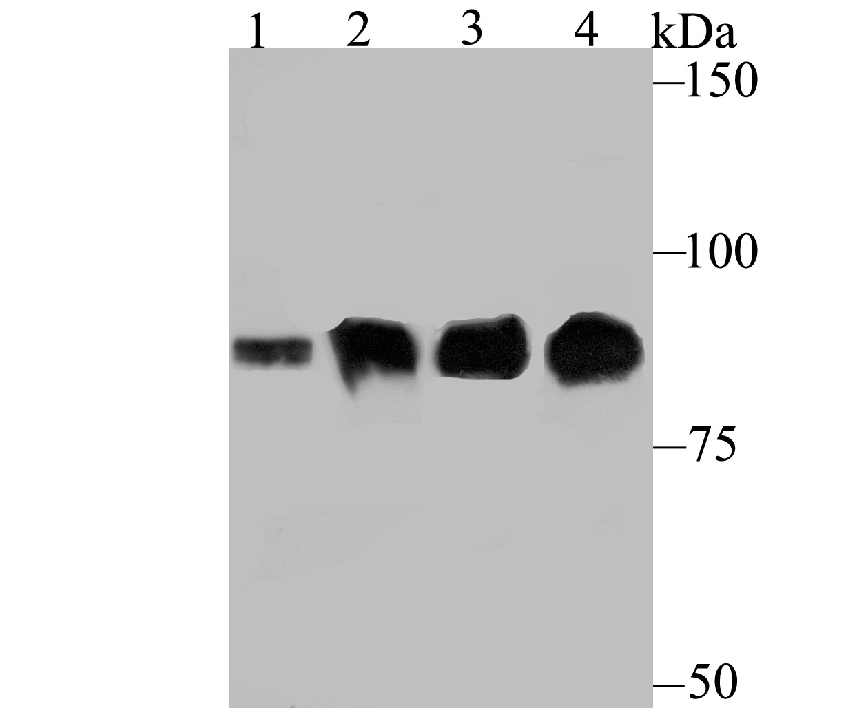 Gelsolin Antibody