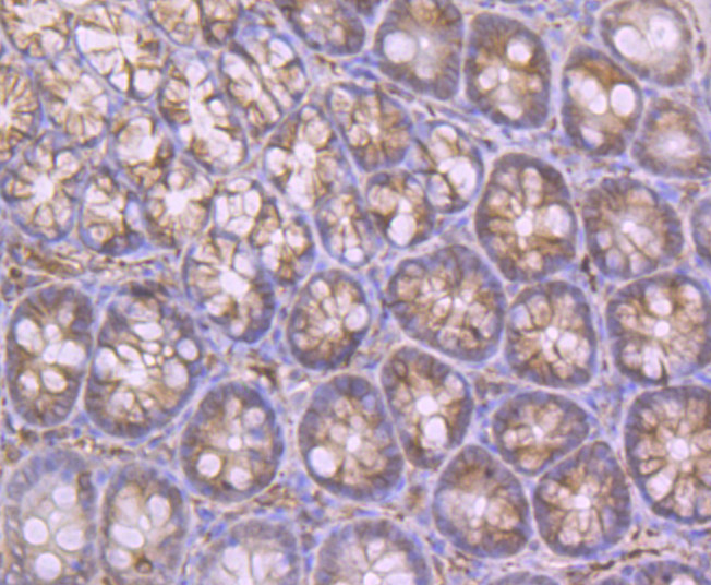 Apolipoprotein A II Antibody