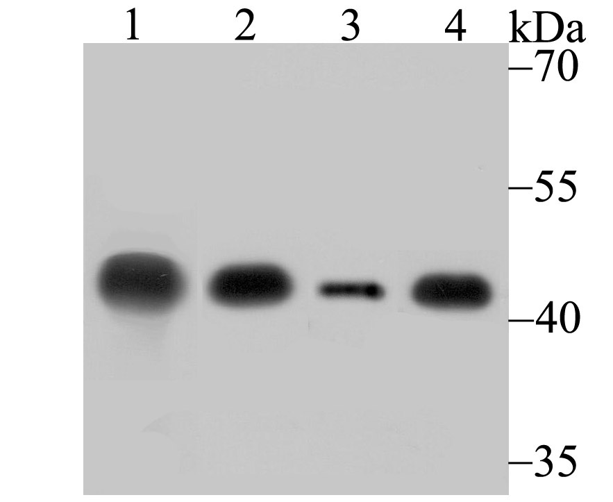 Creatine kinase B type Antibody