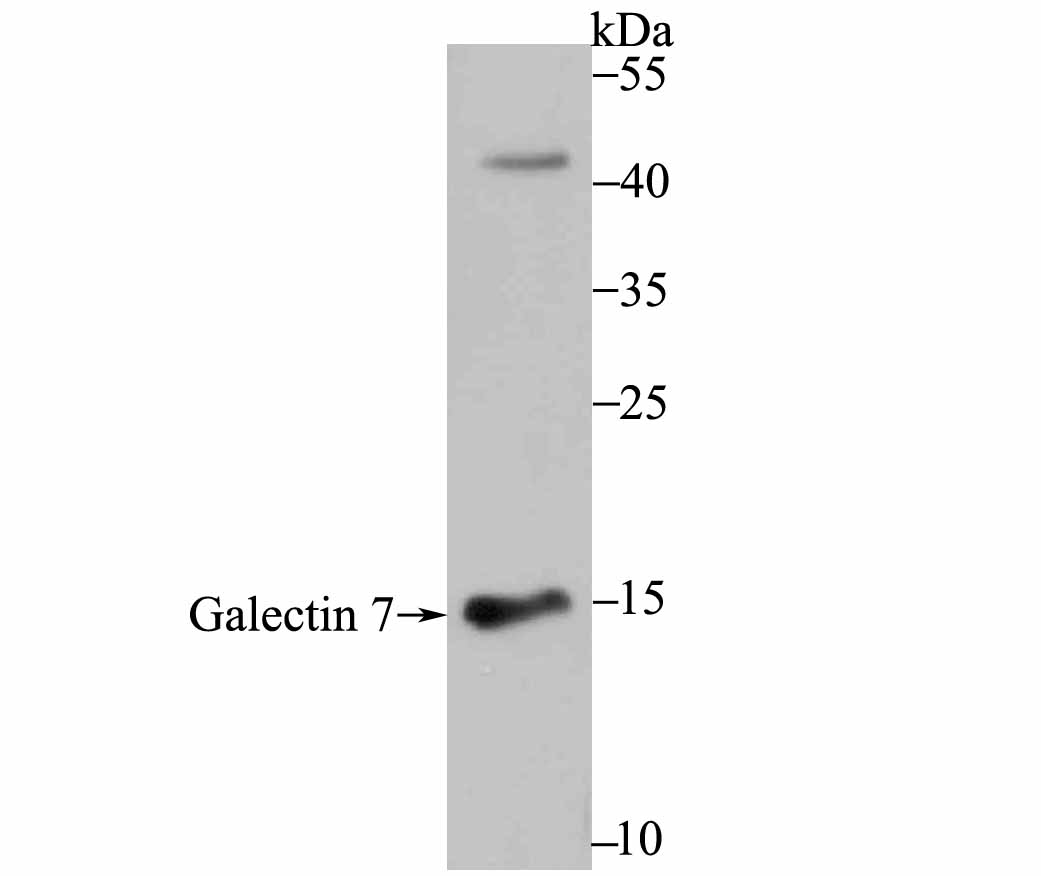 Galectin 7 Antibody