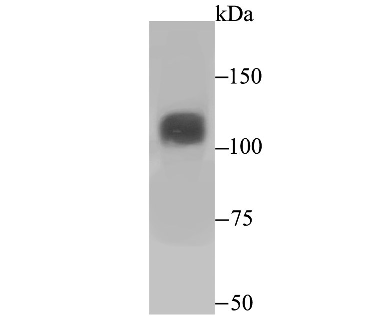 Niemann Pick C1 Antibody