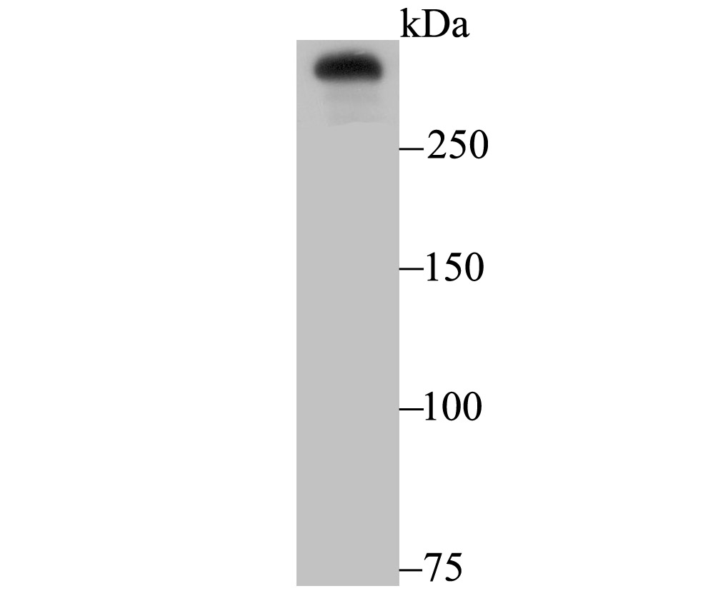 Huntingtin Antibody