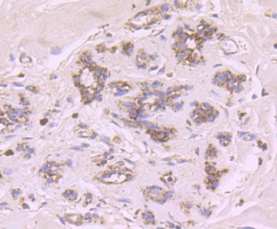 Cytochrome P450 17A1 Antibody