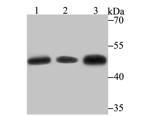 Glutathione Synthetase Antibody