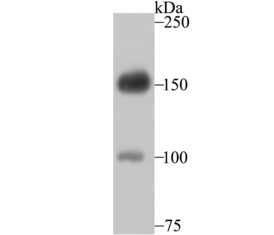 Desmoglein 2 Antibody