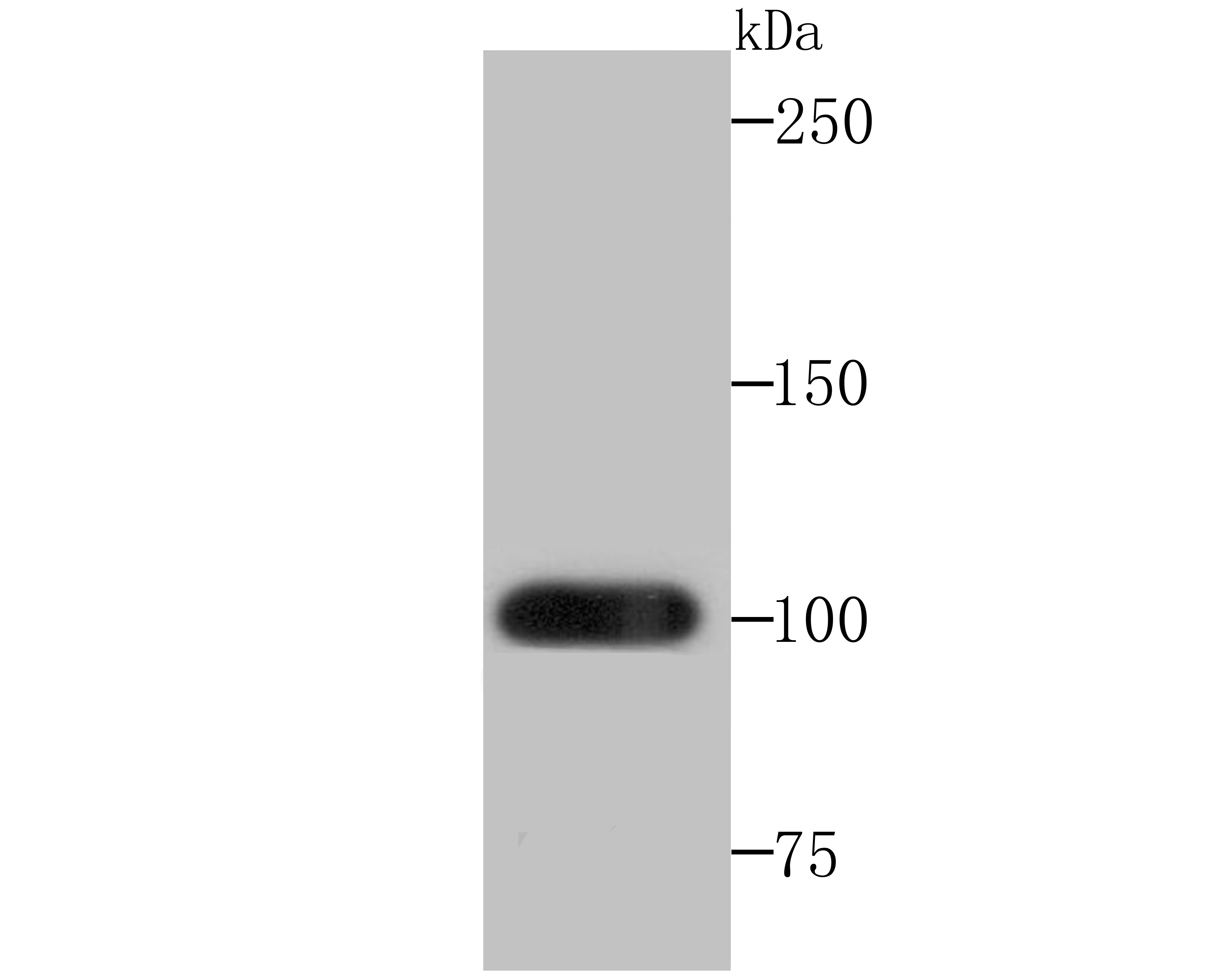 Frizzled 8 Antibody
