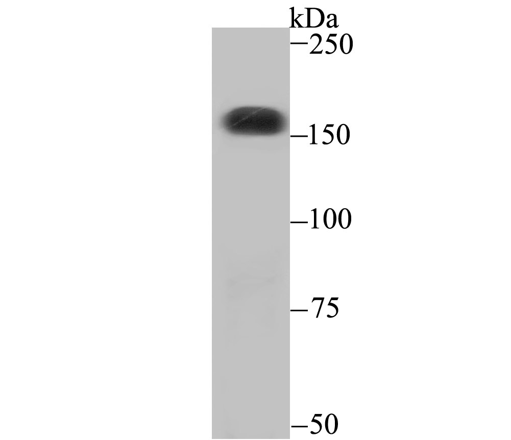 CPS1 Antibody