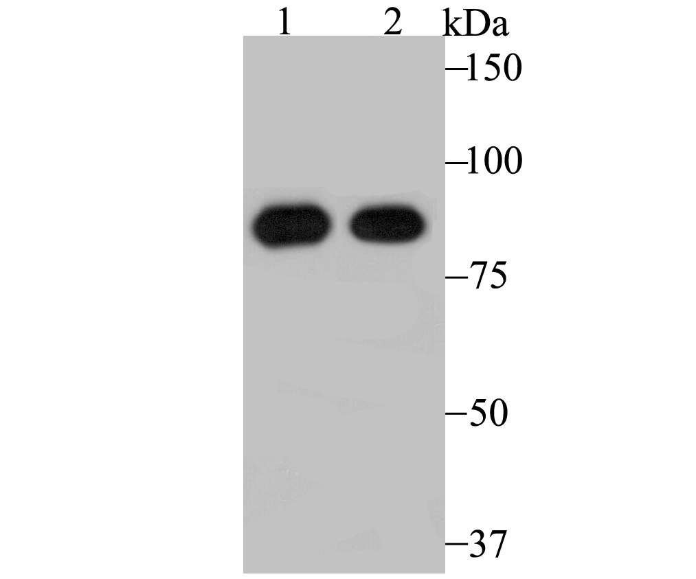 RRM1 Antibody