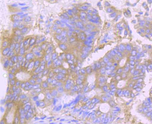 DSG1 Antibody