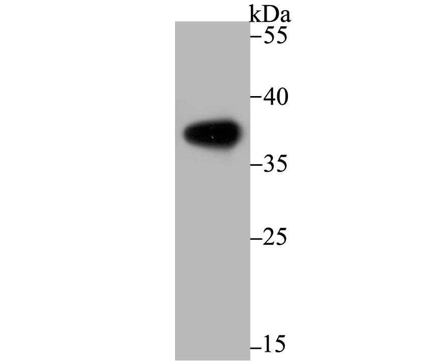 Liver Arginase Antibody