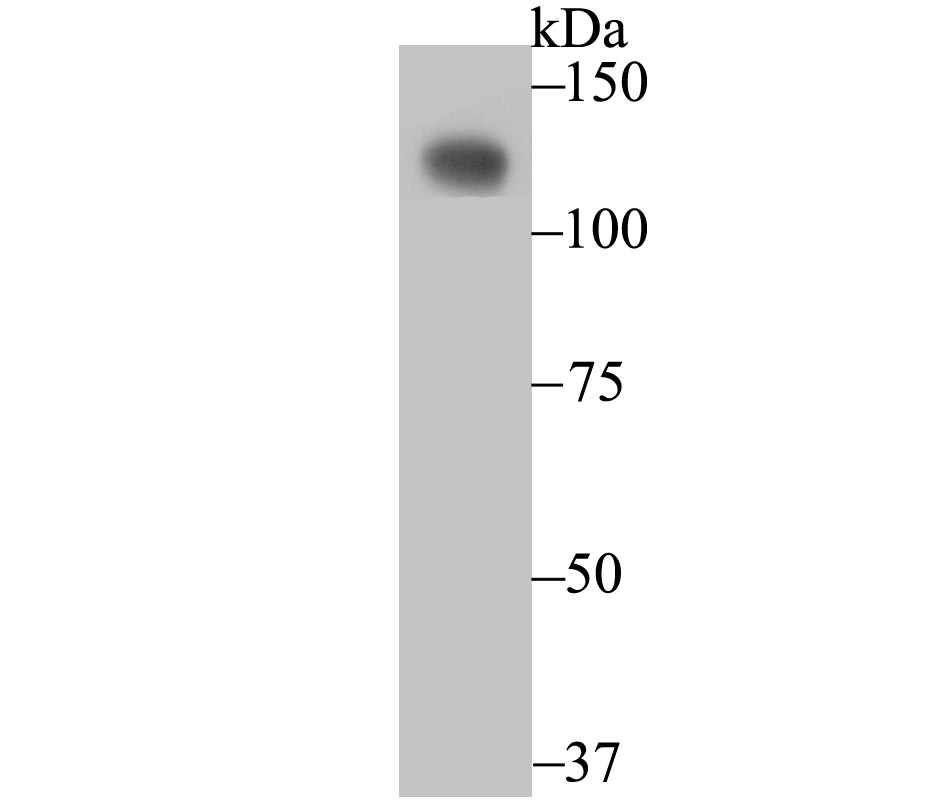 CD146 Antibody