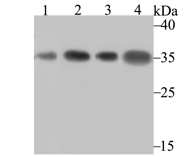 U1A Antibody