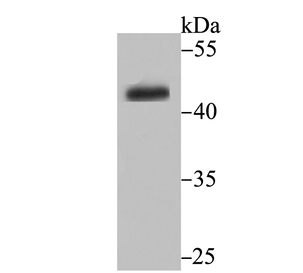 CYP26A1 Antibody