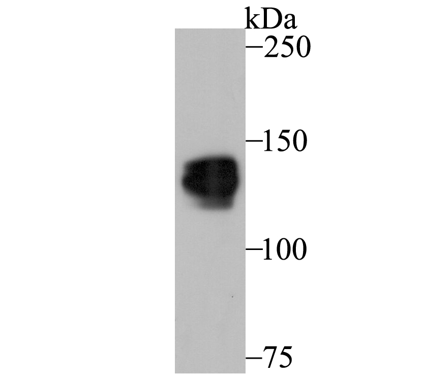 Pumilio 1 Antibody