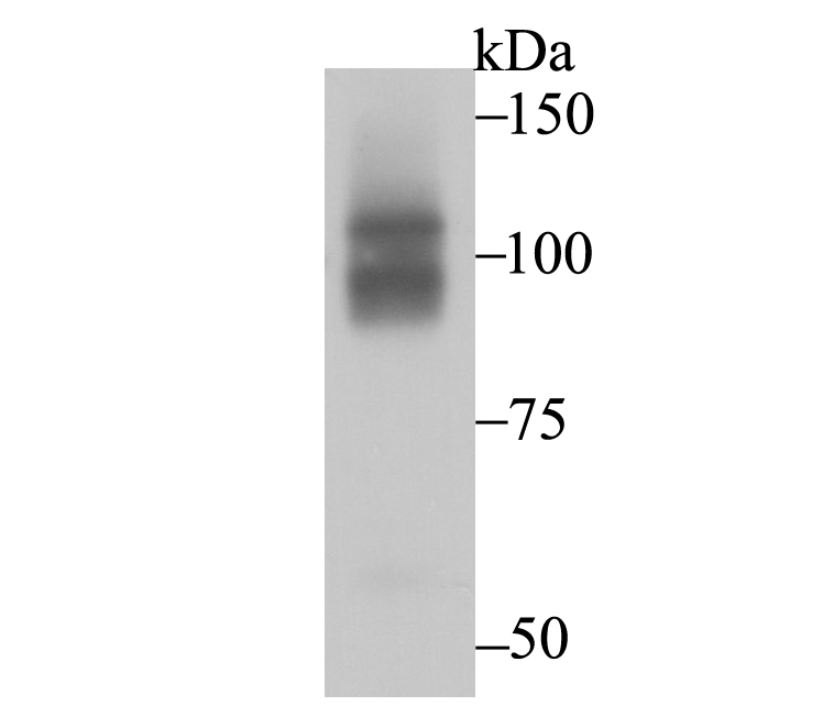 CHD1L Antibody