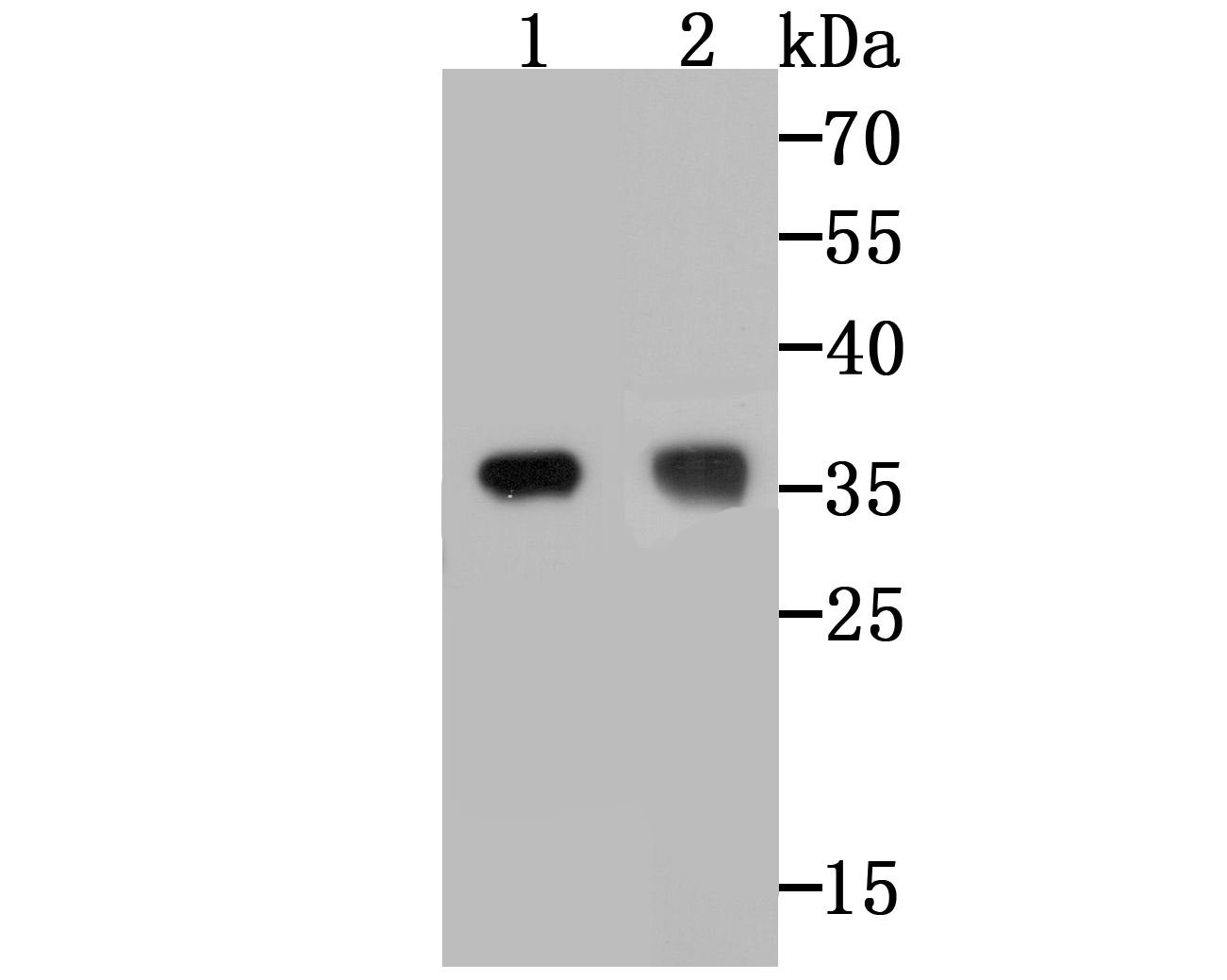 TREX1 Antibody