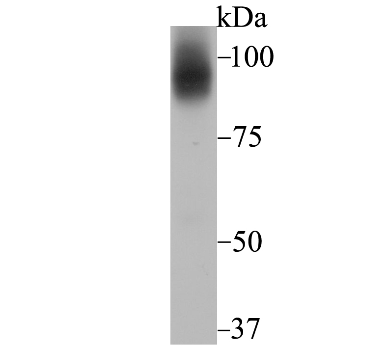 Transferrin Receptor 2 Antibody