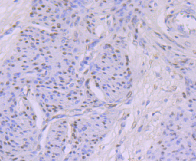 KAT8 Antibody