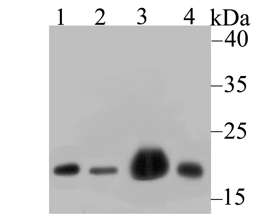 NDUFB8 Antibody