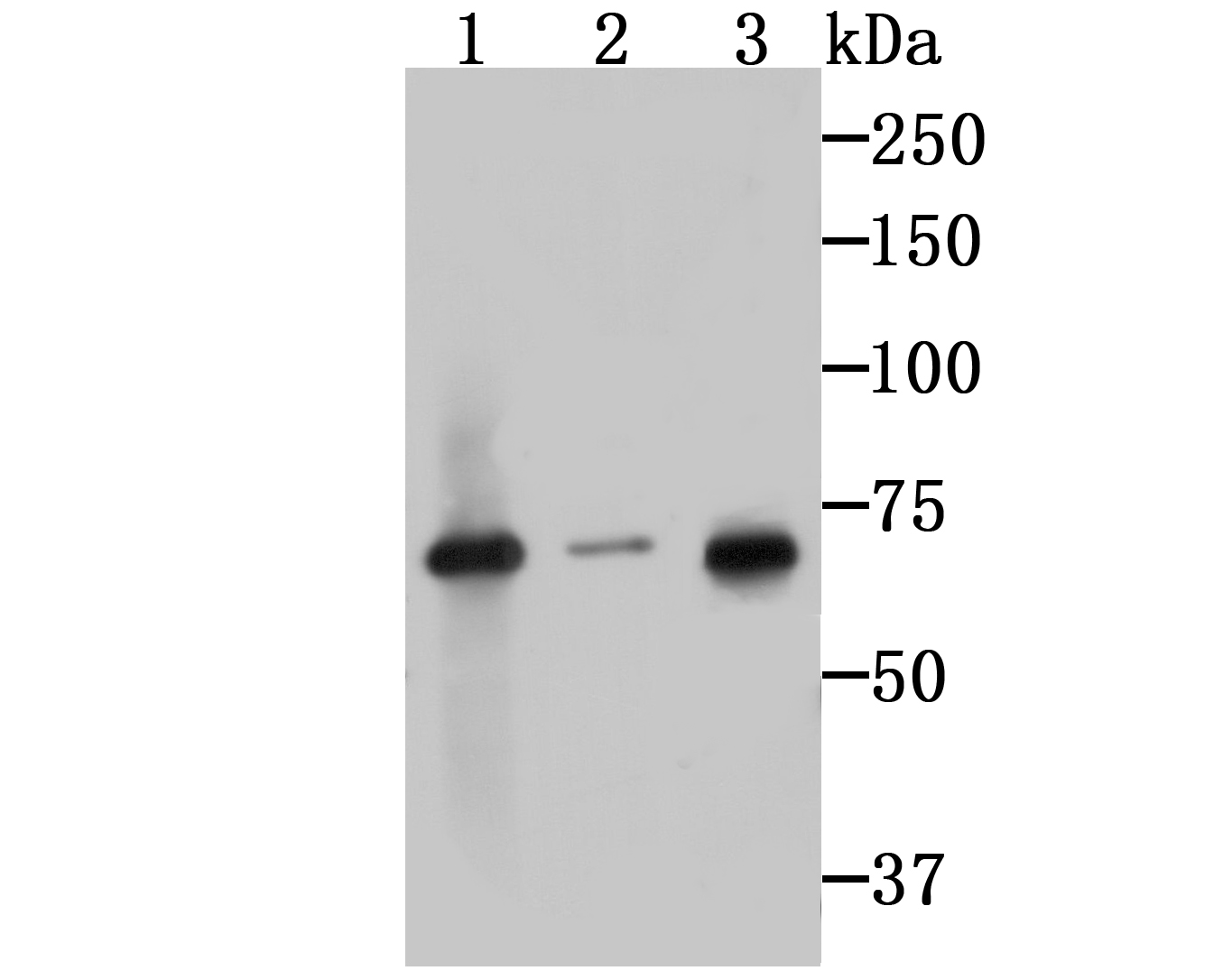 IRAK2 Antibody