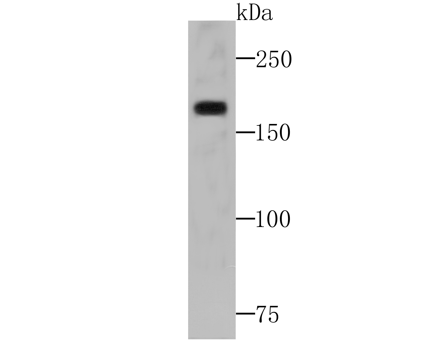 WSTF Antibody