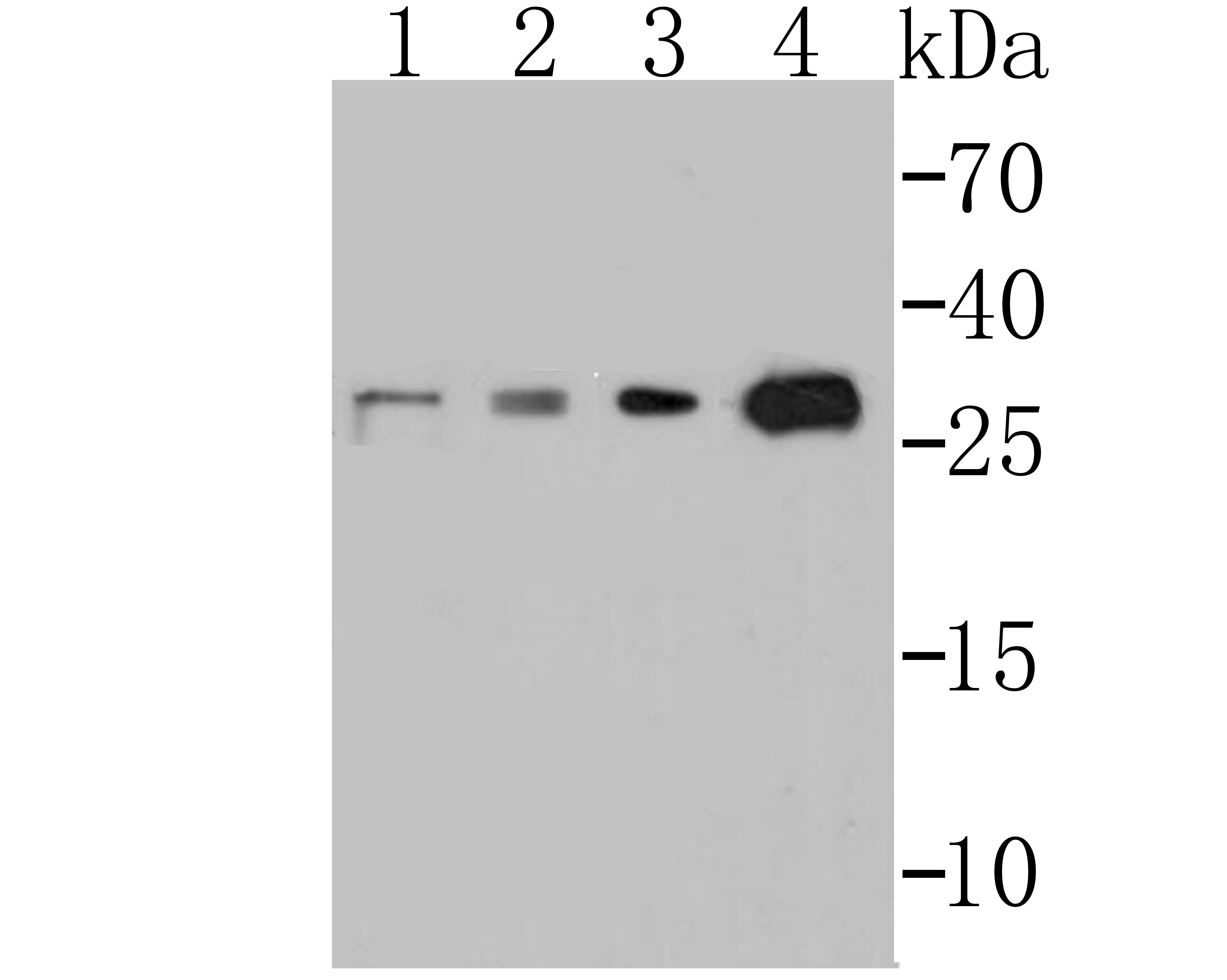 p53 DINP1 Antibody