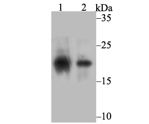 SOCS2 Antibody
