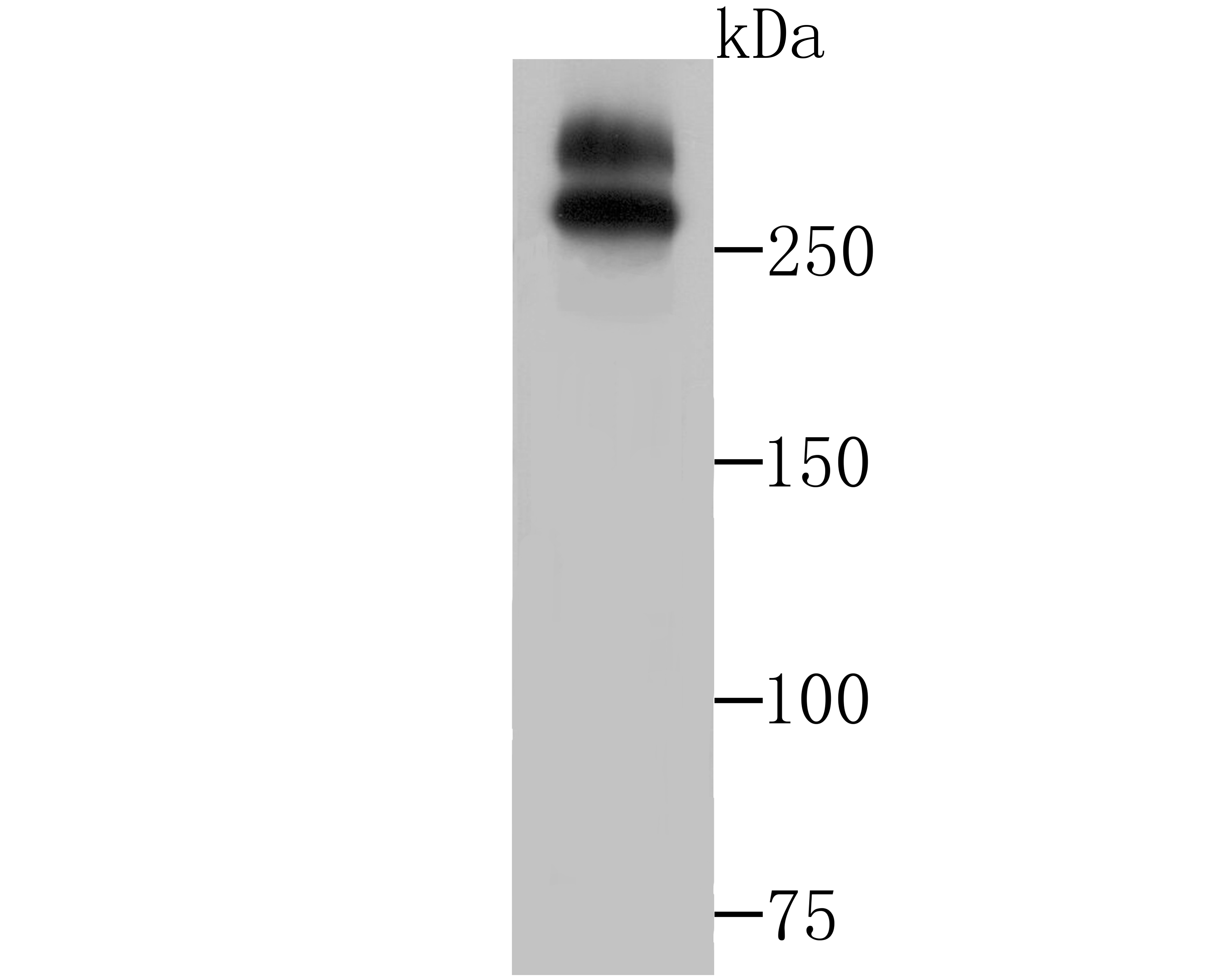 WNK1 Antibody