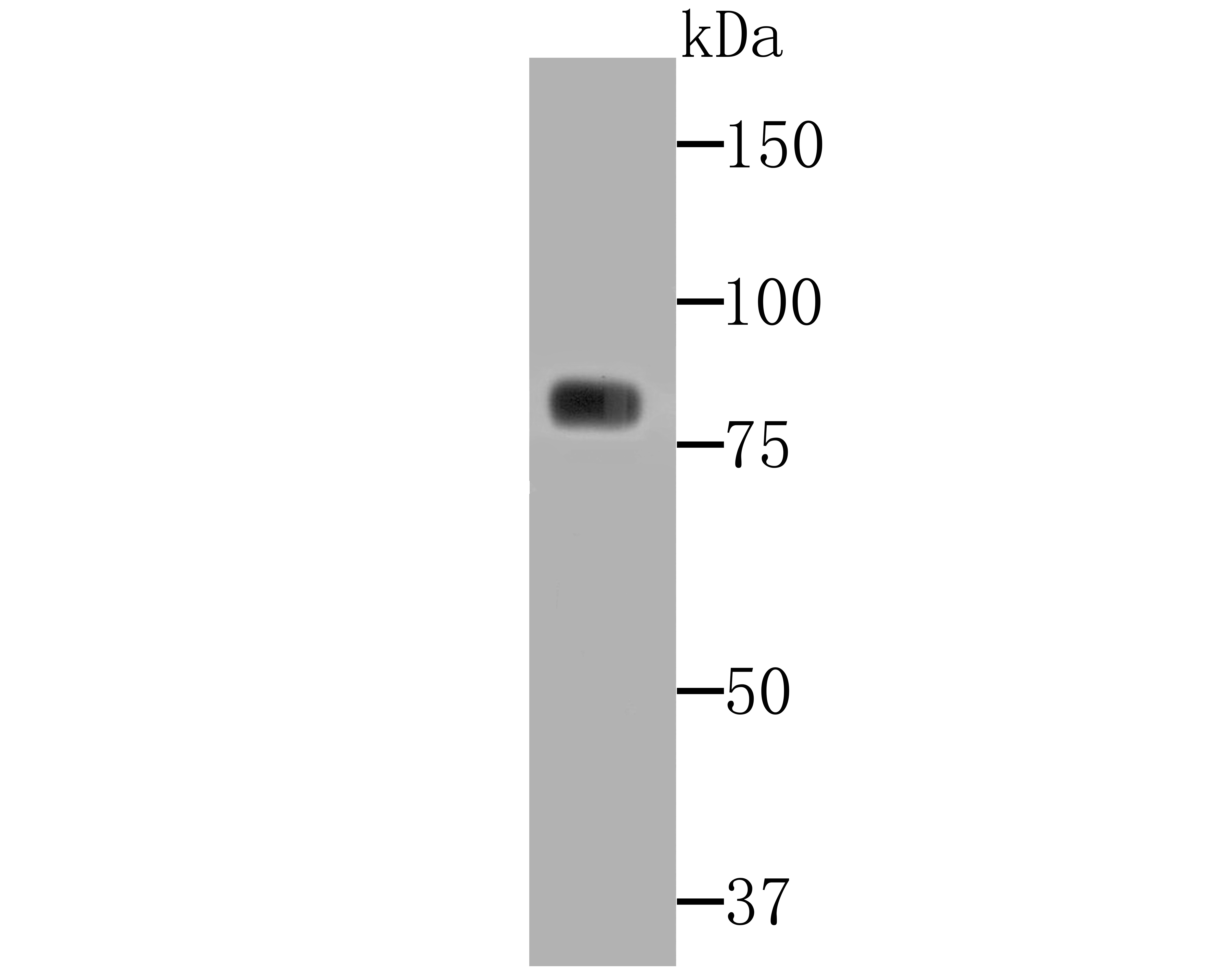 PKC gamma Antibody