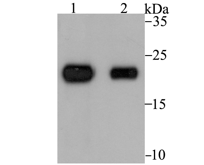 Tetranectin Antibody