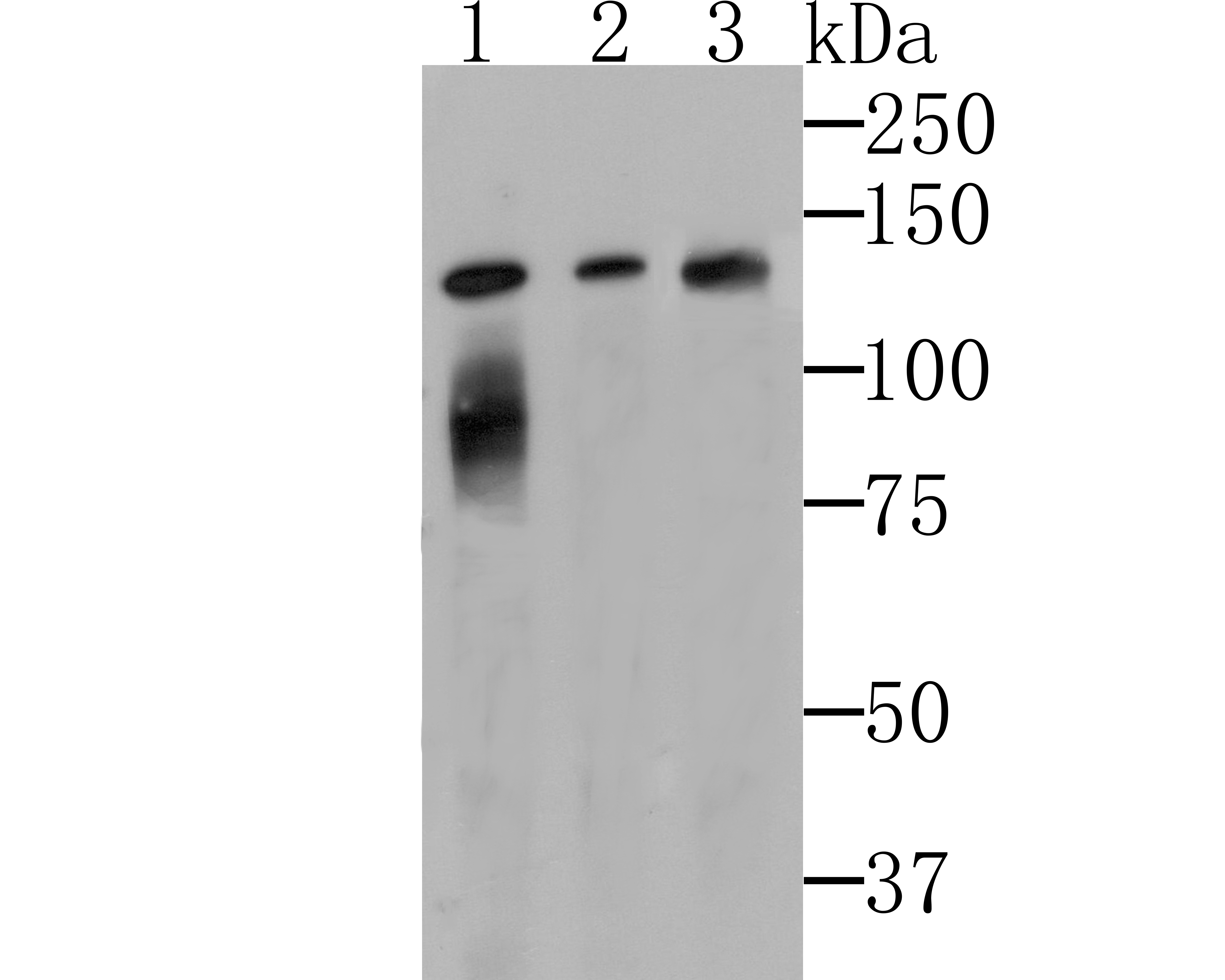 Lipin 1 Antibody
