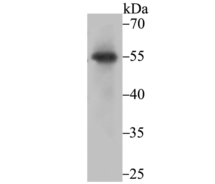 PIST Antibody