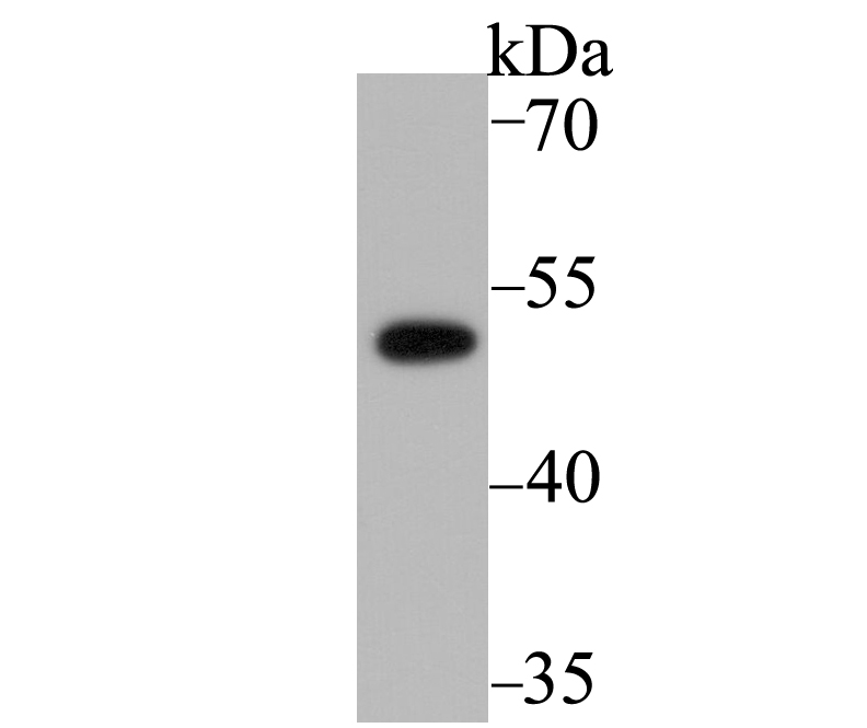 PICK1 Antibody