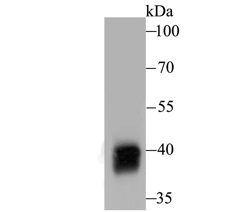 Alcohol Dehydrogenase Antibody