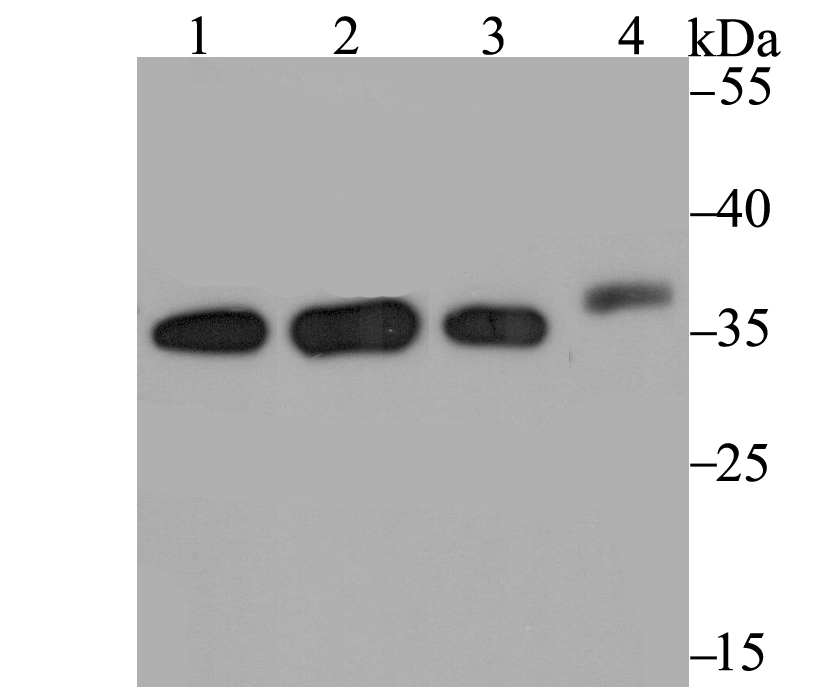 STUB1 Antibody