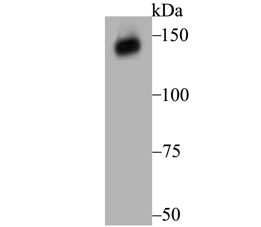 Xanthine Oxidase Antibody