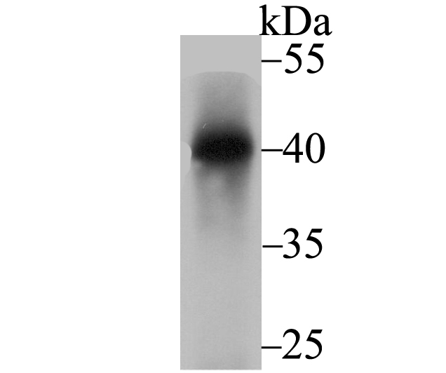 Nudel Antibody
