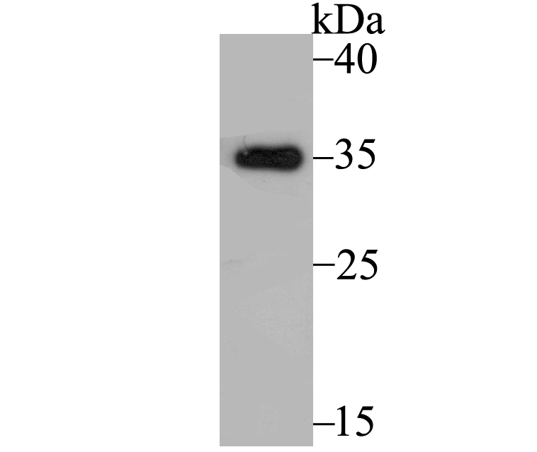 Tropomyosin 1 Antibody