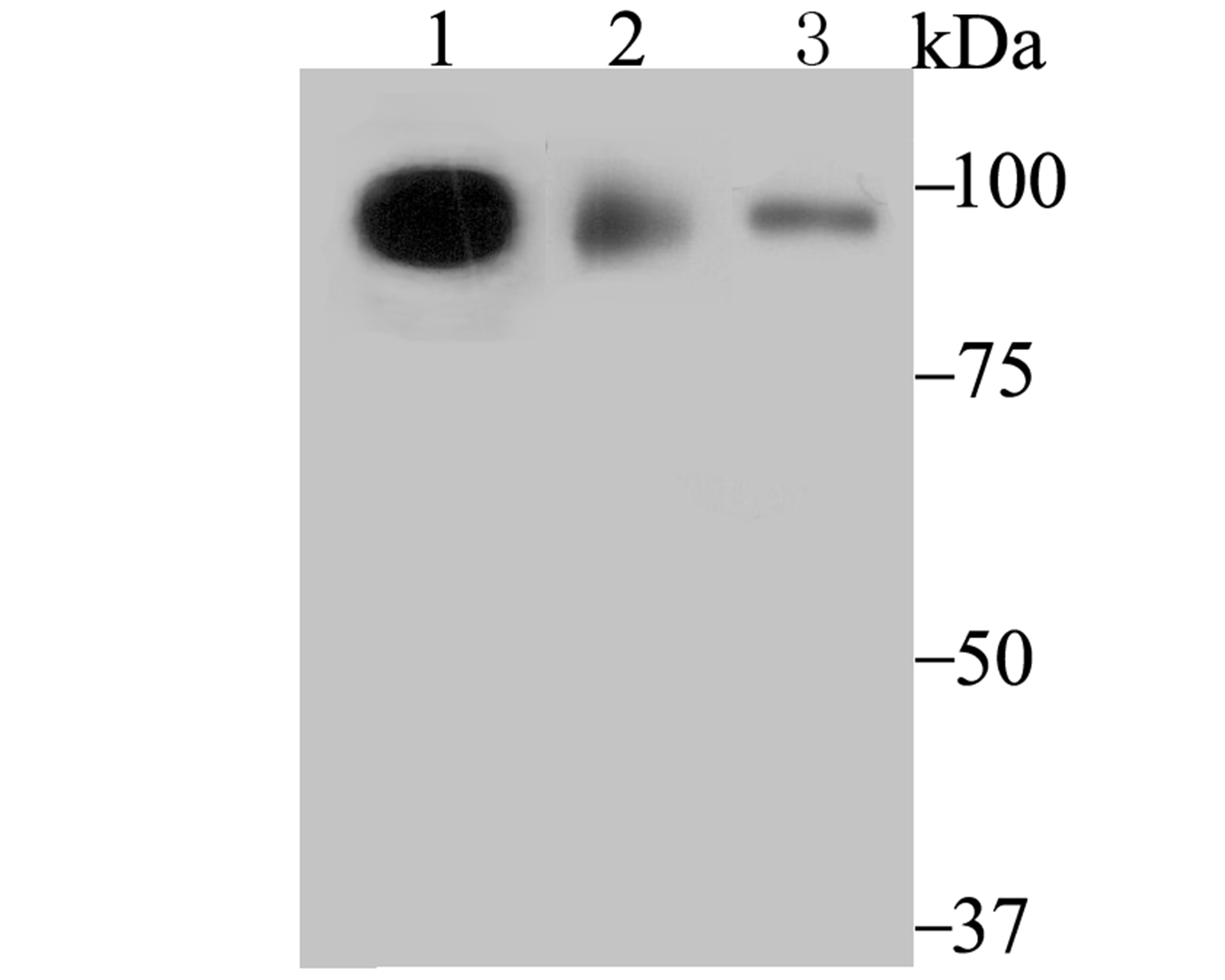TNPO3 Antibody