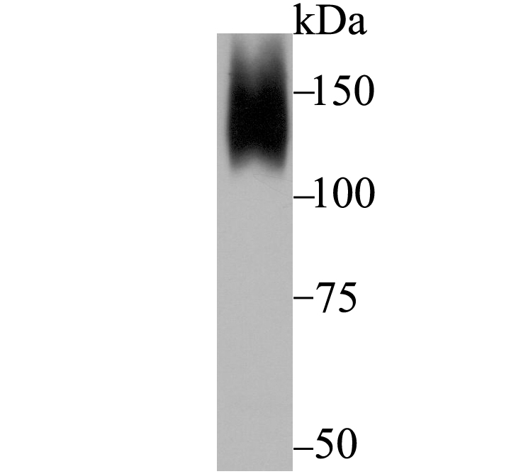 ORP150 Antibody