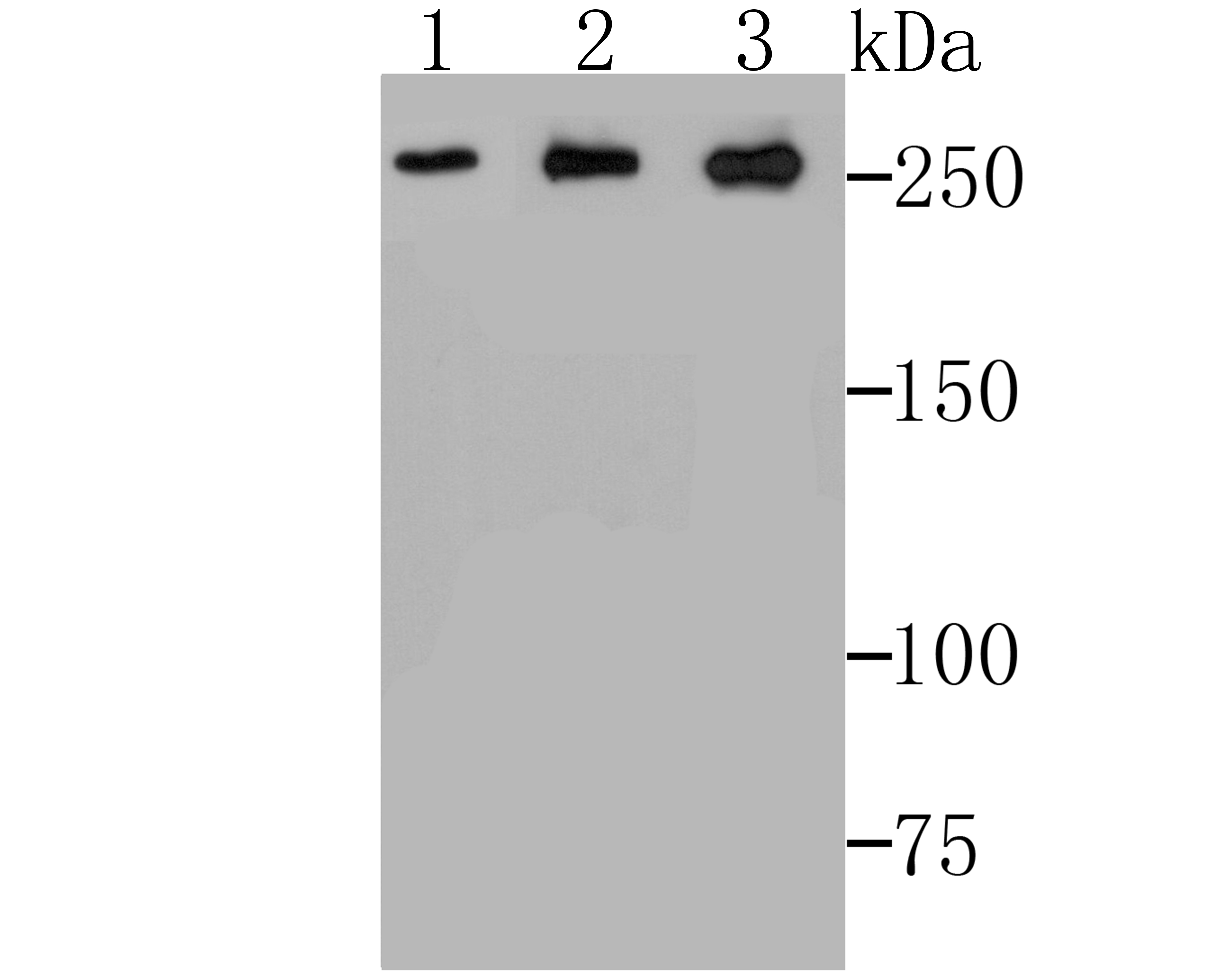 ADAMTS13 Antibody