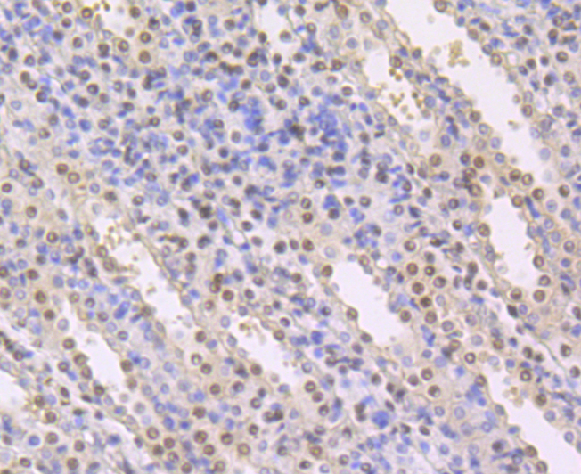 CBFb Antibody