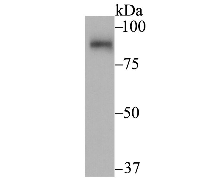 SUN1 Antibody