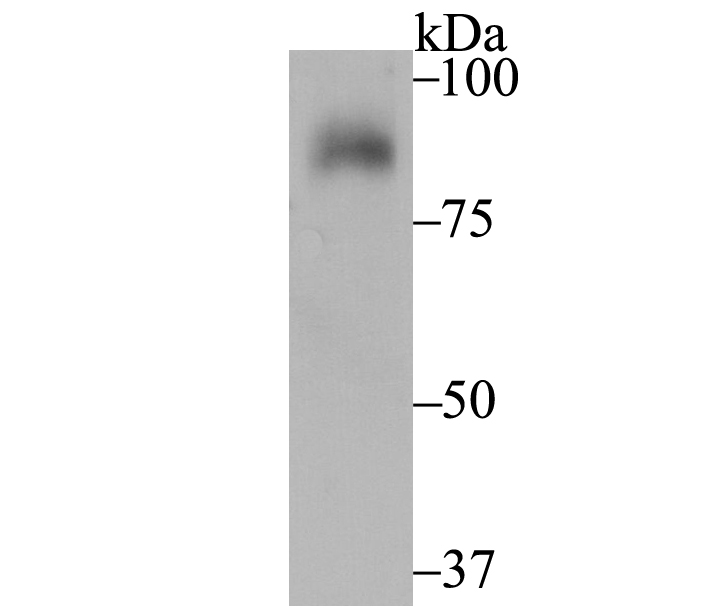 SUN2 Antibody