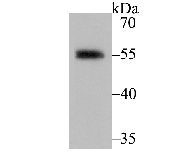 Retinoid X Receptor alpha Antibody